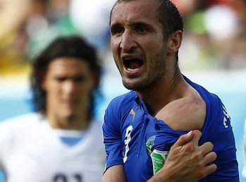 14- مدافع إيطاليا جورجيو كيليني يثبت للحكم أنه تعرض للعض من لويس سواريز 