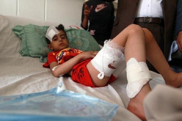 اليونيسيف: مقتل 62 طفلا منذ اندلاع المعارك باليمن