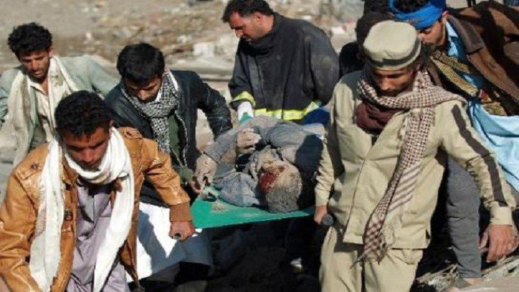 عشرات القتلى بمعارك في اليمن.. وقصف قاعدة عسكرية في صنعاء