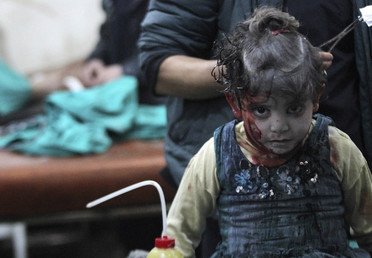 فتاة سورية جرحت أثناء قصف جوي تنتظر دورها لتلقي مساعدة طبية
