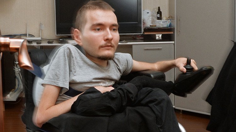 ألمانيا لم توافق على إجراء عملية زرع رأس الإنسان في مستشفياتها