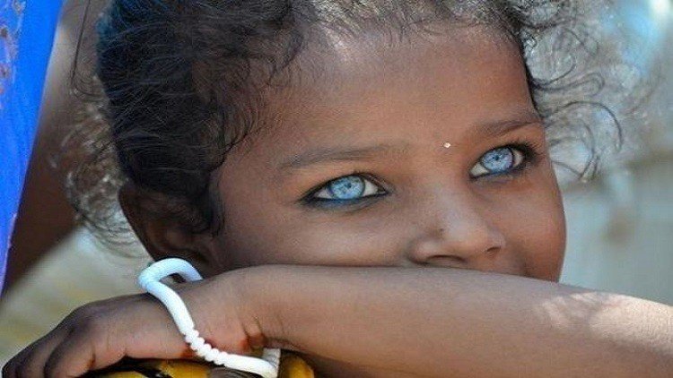 علماء أمريكيون يستعدون لإجراء عملية زرع عين
