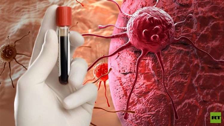 روسيا.. بدء اختبار مستحضر "نووي" لعلاج سرطان الكبد