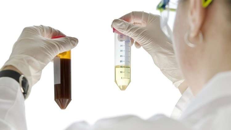 مفاجأة علمية..تطوير خلايا دماغية بدلا من الكلى البشرية في المختبر