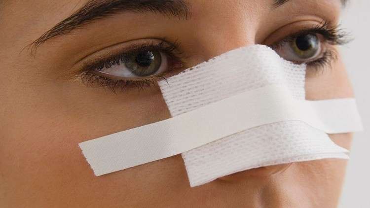 تقنية مذهلة لتجميل الأنف خلال 5 دقائق ودون جراحة!