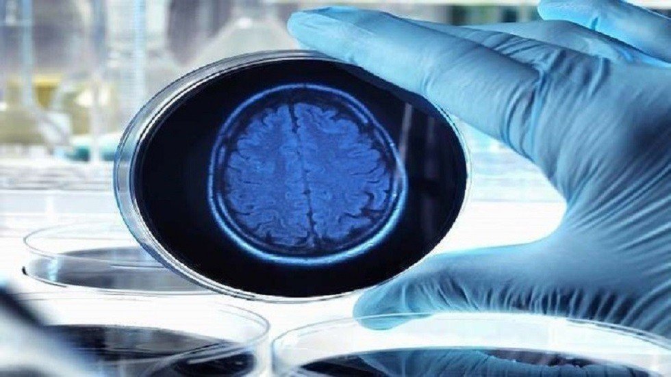 اكتشاف جديد يعطي أملا لعلاج الأعراض المبكرة لمرض ألزهايمر