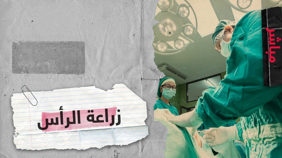 طبيب بريطاني: أولى عمليات زرع الرأس  ستنطلق بحلول عام 2030.. هل يتحقق ذلك؟