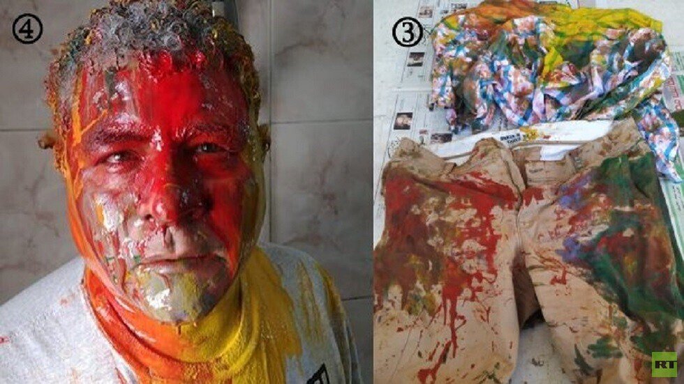 مصر.. ناشط حقوقي ينشر صورا لـ "اعتداء الأمن" عليه ومصادر تكشف لـ RT الحقيقة