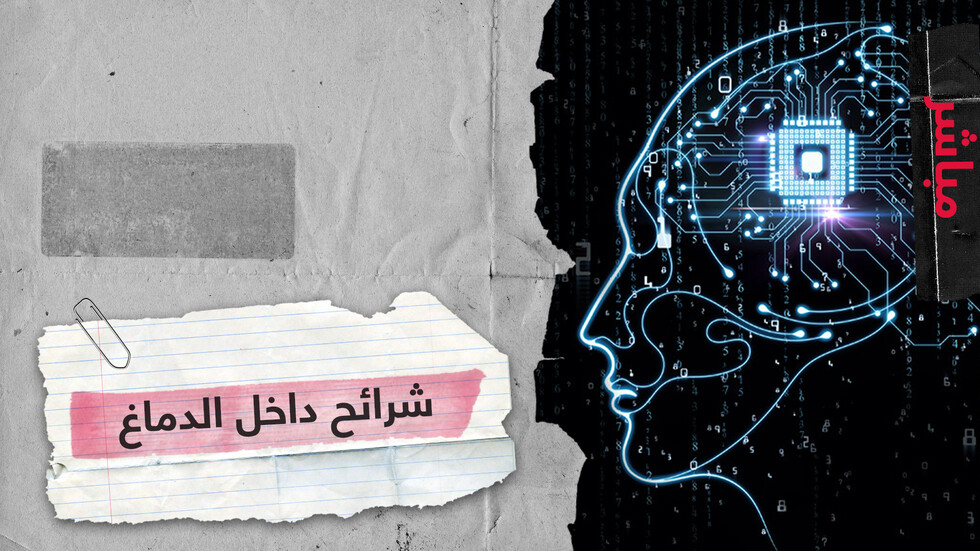 ليس خيالا علميا.. زرع شرائح إلكترونية في المخ لعلاج الأمراض وتطوير القدرات البشرية!
