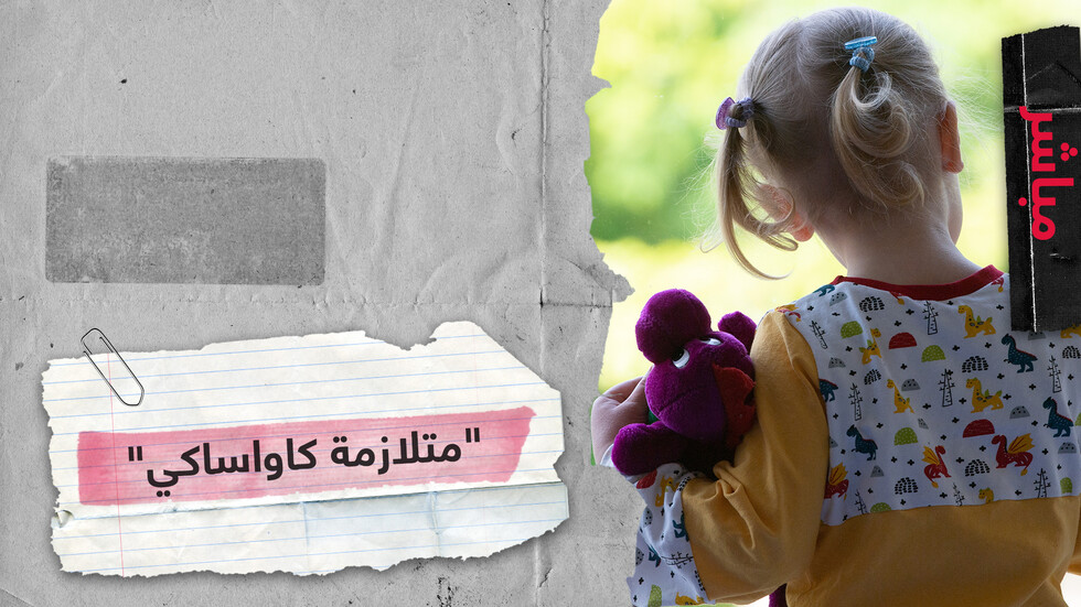 ما علاقة "متلازمة كاواساكي" لدى الأطفال بفيروس كورونا؟