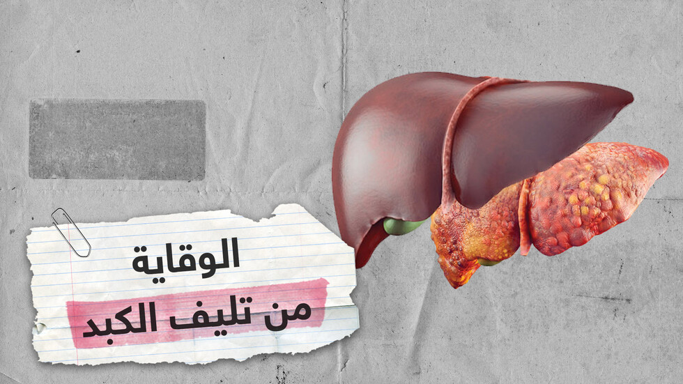 معلومات تهمك للوقاية من تليُّف الكبد