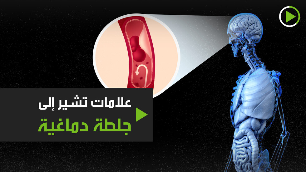 علامات تشير إلى جلطة دماغية وشيكة