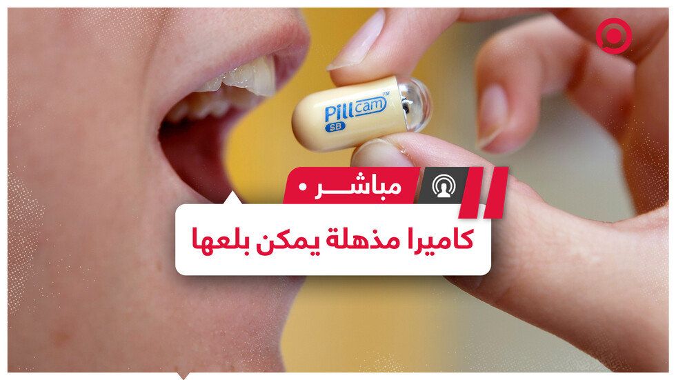 كاميرا متناهية الصغر في كبسولة قابلة للبلع يمكنها تشخيص سرطان القولون خلال ساعات