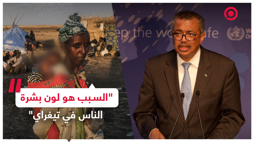 الصحة العالمية تتهم قادة العالم بالعنصرية فيما يتعلق بأزمتي أوكرانيا وتيغراي