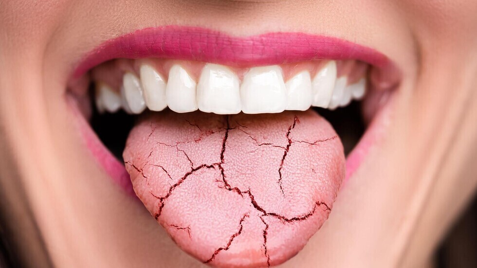 أفضل أنواع الفاكهة لمنع الجفاف خلال أشهر الصيف الحارة