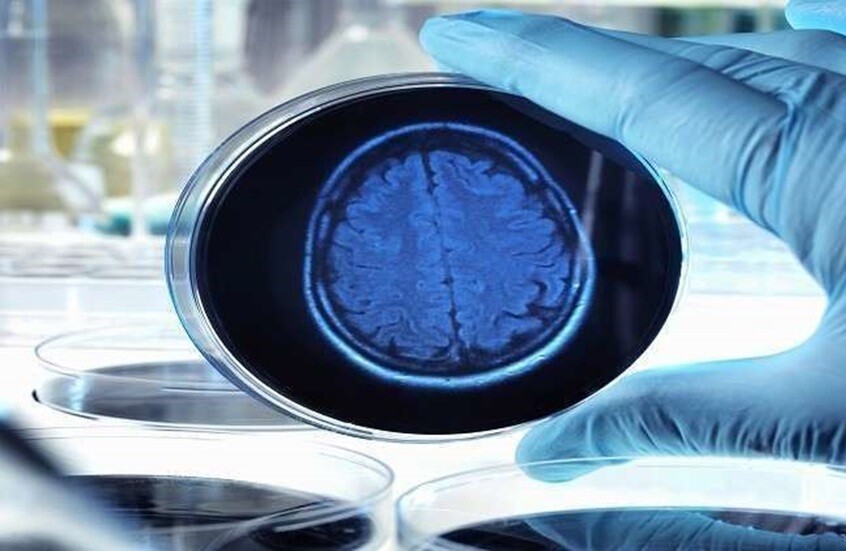 سابقة علمية.. أدمغة بشرية مزروعة في الفضاء قد تساعد في علاج الأمراض العصبية الخطيرة
