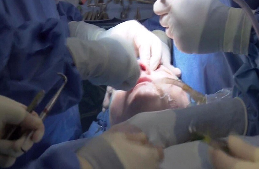 حالات مرضية تمنع إجراء عمليات تجميل الأنف