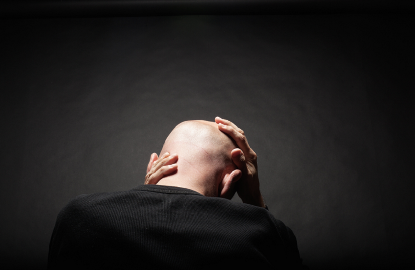 للوقاية من الصلع.. احذروا مشاركة هذه الأشياء
