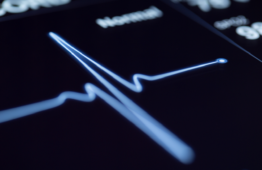 واقعة طبية غريبة: فحص شرجي يعيد نبض قلب شاب إلى طبيعته فورا