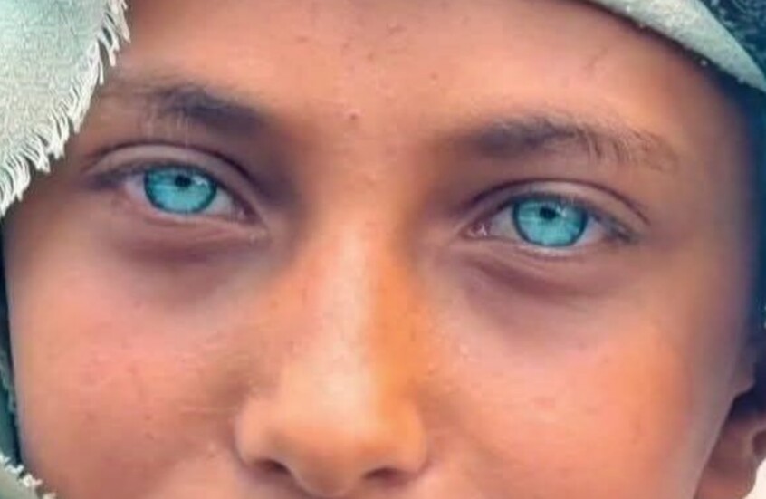 "رسام" اليمني يخطف أضواء  الحرب بعينيه ويتحول لظاهرة على السوشيال ميديا