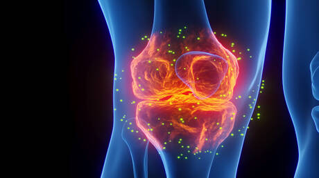علاقة مثيرة للجدل بين النقرس وضعف الانتصاب