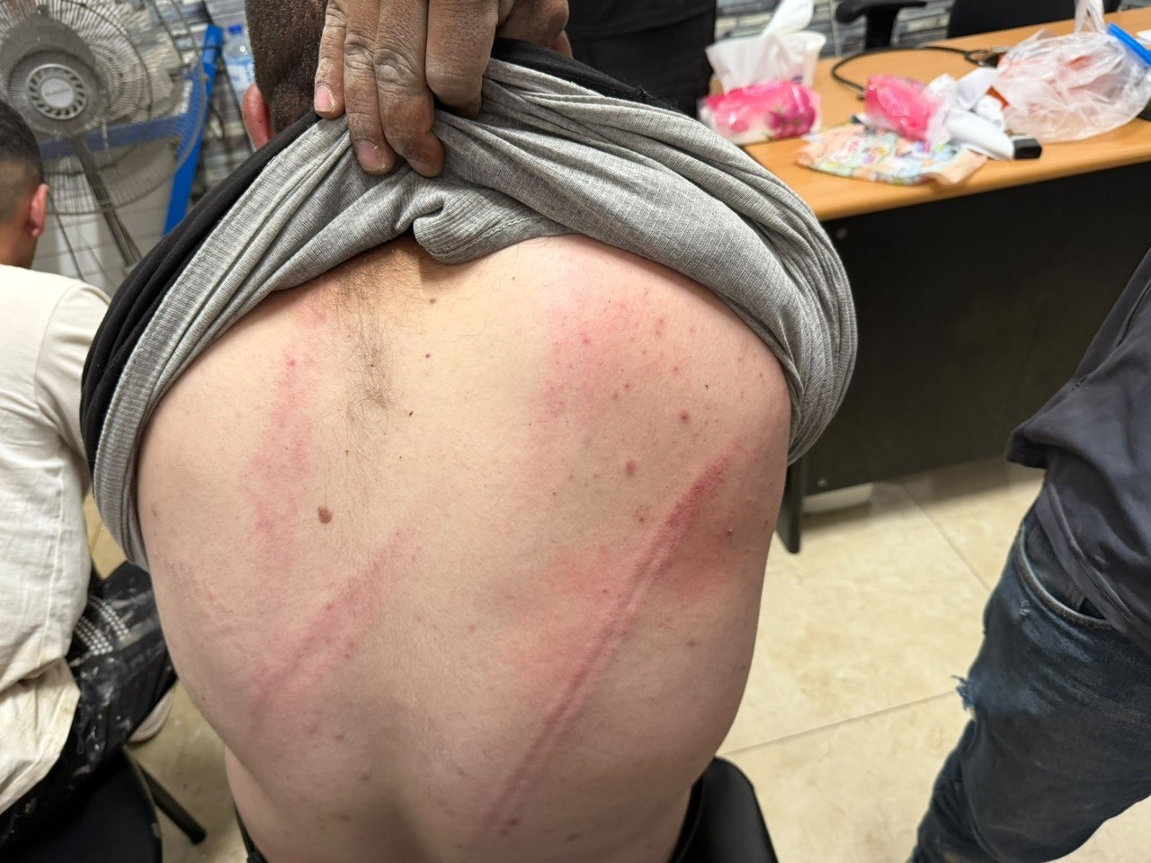إصابات أخرى في دير بزيع غرب رام الله باعتداءات المستوطنين على قاطفي الزيتون